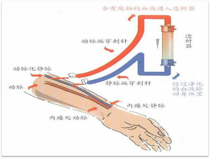 科普肾脏,医学科普出汗和肾脏关系