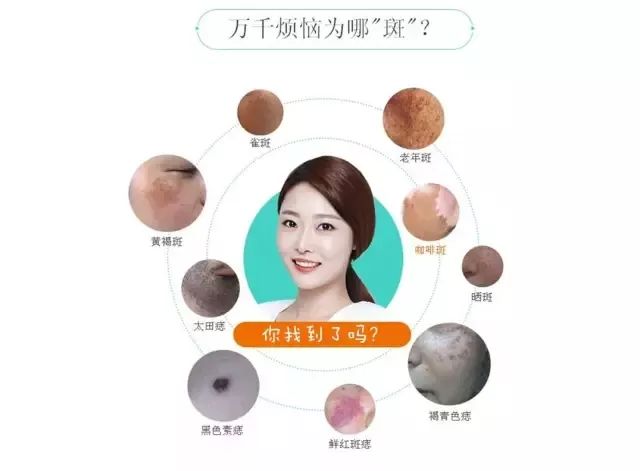 怀孕变丑真正原因,什么时候怀孕变难看