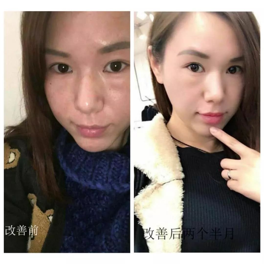 怀孕变丑真正原因,什么时候怀孕变难看