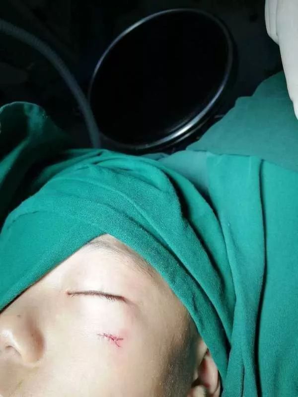 6岁男童意外跌落致脾脏破,甘肃岁男孩骑车摔倒扎破眼球