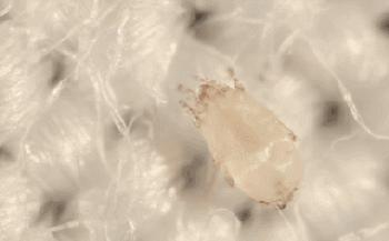 20分钟清理背部螨虫痘痘,十秒去除螨虫