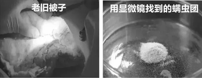 不用洗床单晒被子怎么除螨虫,螨虫去除妙招不用花露水