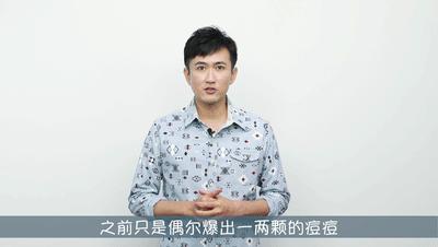 要你好看|听过很多祛痘方法,却还是收拾不了“车祸脸”?