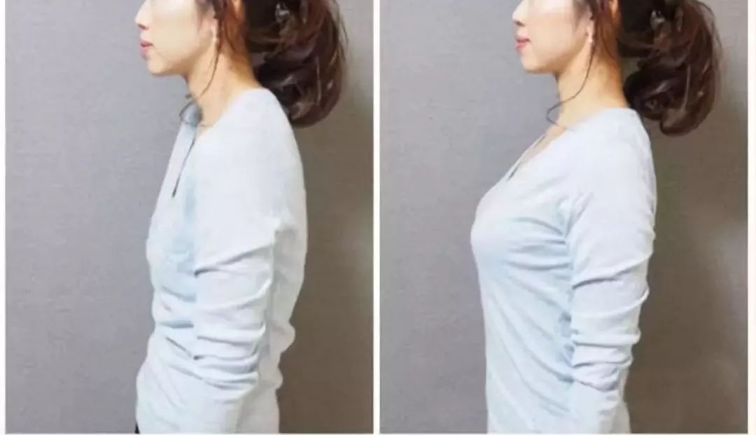 改善含胸驼背的最有效方法10分钟,改善含胸驼背的最有效方法完整版