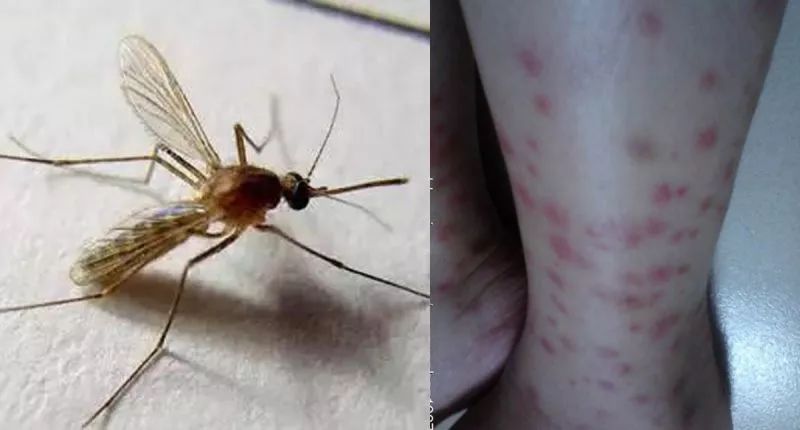 泰国防蚊虫叮咬药膏推荐,蚊子叮咬泰国青草膏哪种止痒最快