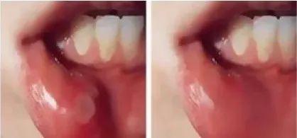 牙龈上火、红肿，还口臭？香港人用了91年的中药牙膏，消炎抑菌，让你刷出一口健康好牙