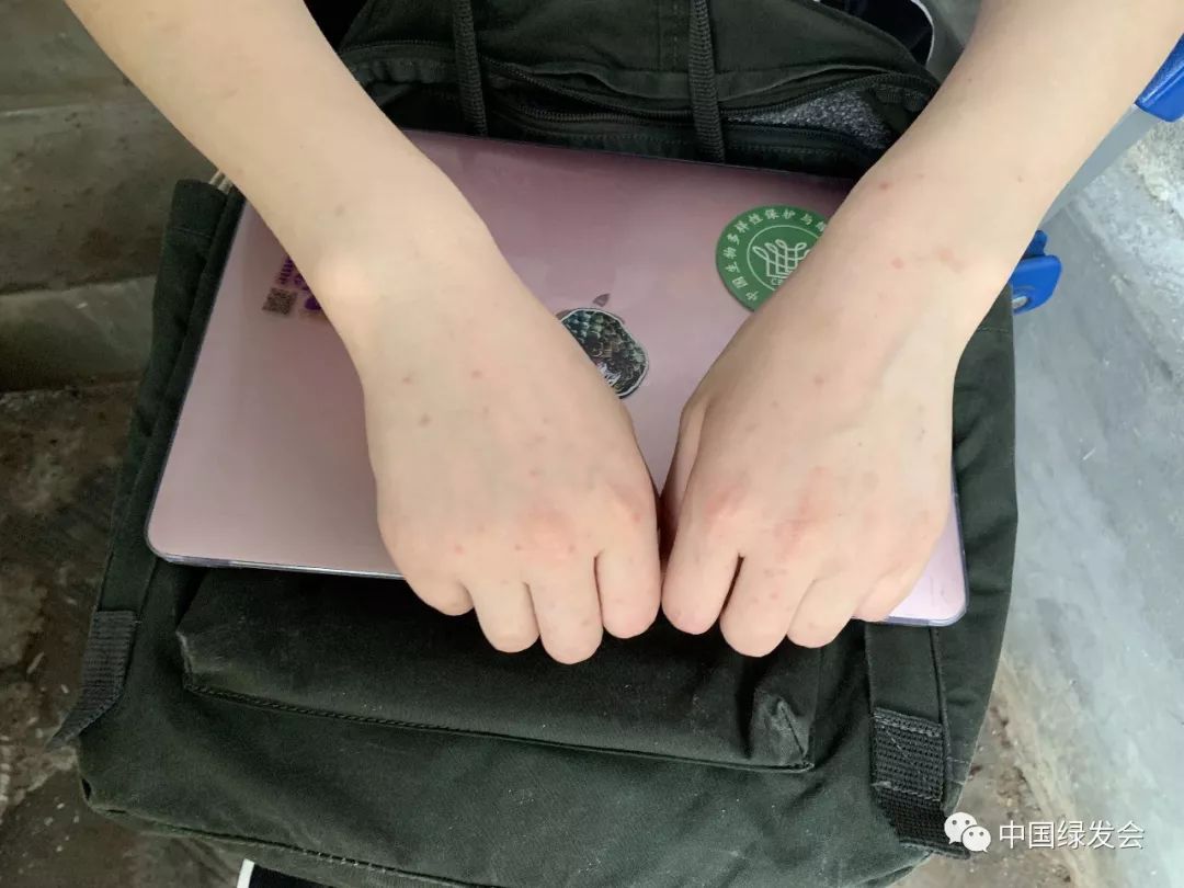 蜱虫黑虫,蜱虫天敌红蚂蚁