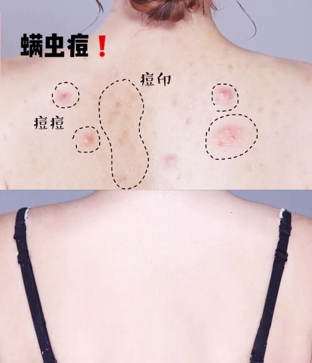 为什么能从鼻头上挤出白色的东西,鼻子挤出来的白丝是什么