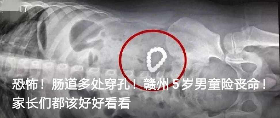 江西赣州三支一扶2023入围,江西赣州三支一扶有面试吗