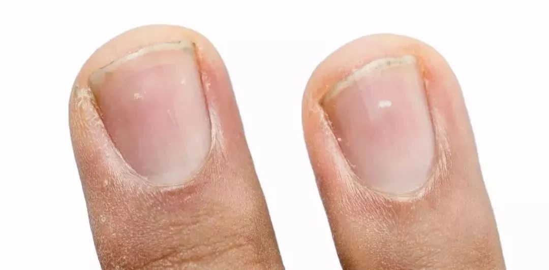 儿童专家讲挑食,专家说孩子挑食怎么办