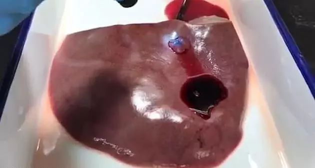 新型神奇胶水,新型生物胶水止血