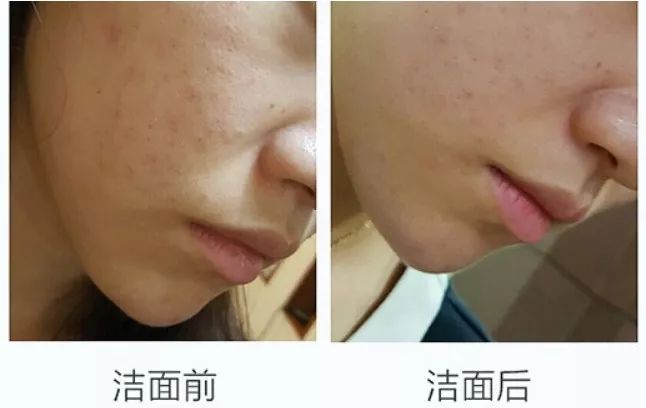 脸不干净有啥洗面奶好用,脸洗不干净用的护肤品