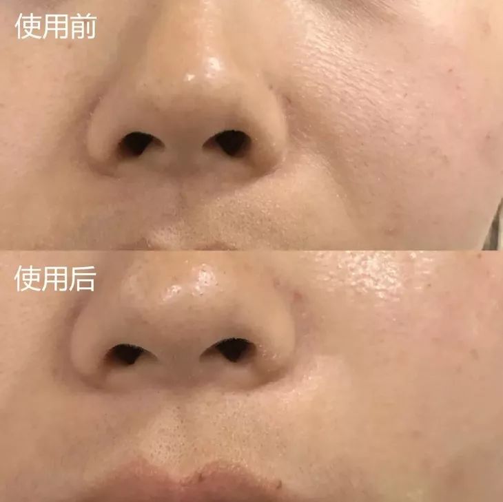 熬夜急救大牌面霜,熬夜急救涂抹大牌面膜