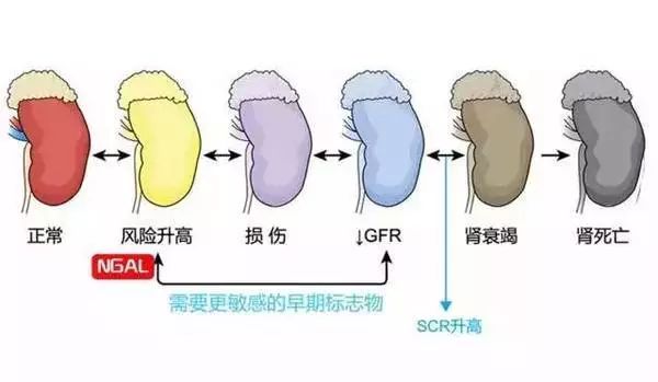 肾坏了，心还能好吗？