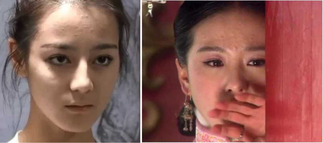 重要场合灰头土脸？16条急救措施帮你焕然一新！