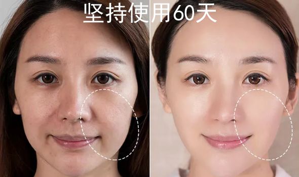 日本黑科技磁石瘦脸耳环,日本磁吸瘦脸耳环