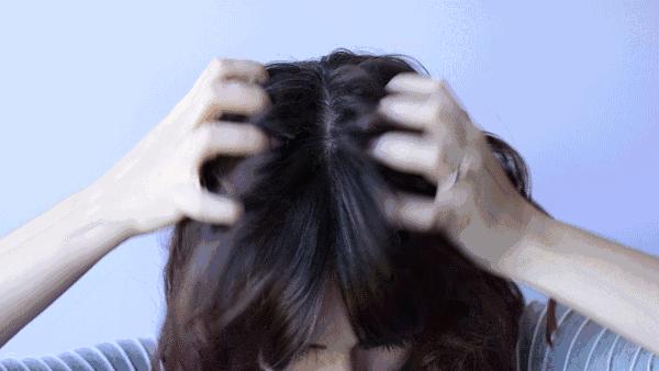 头皮发痒爱出油是什么引起的,头皮出油严重痒是什么原因引起的