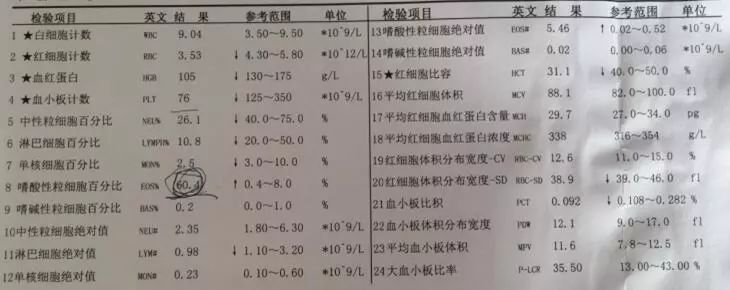 亚急性心内膜炎有蛋白尿吗,loeffler心内膜炎发病概率