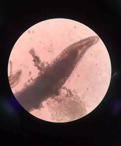 四岁女宝宝总说小便处痒,女宝宝每天说屁痒用什么药