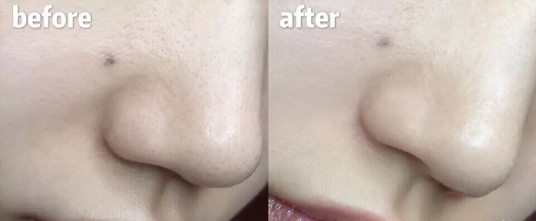 人鱼公主嫌弃婆家穷,人鱼公主下嫁却遭婆婆嫌弃