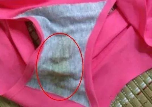 怎样去除女裤内裆异味,内衣裤处瘙痒小妙招