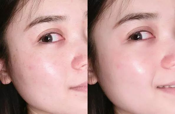 可以变白的维c推荐,维c既美白又抗老