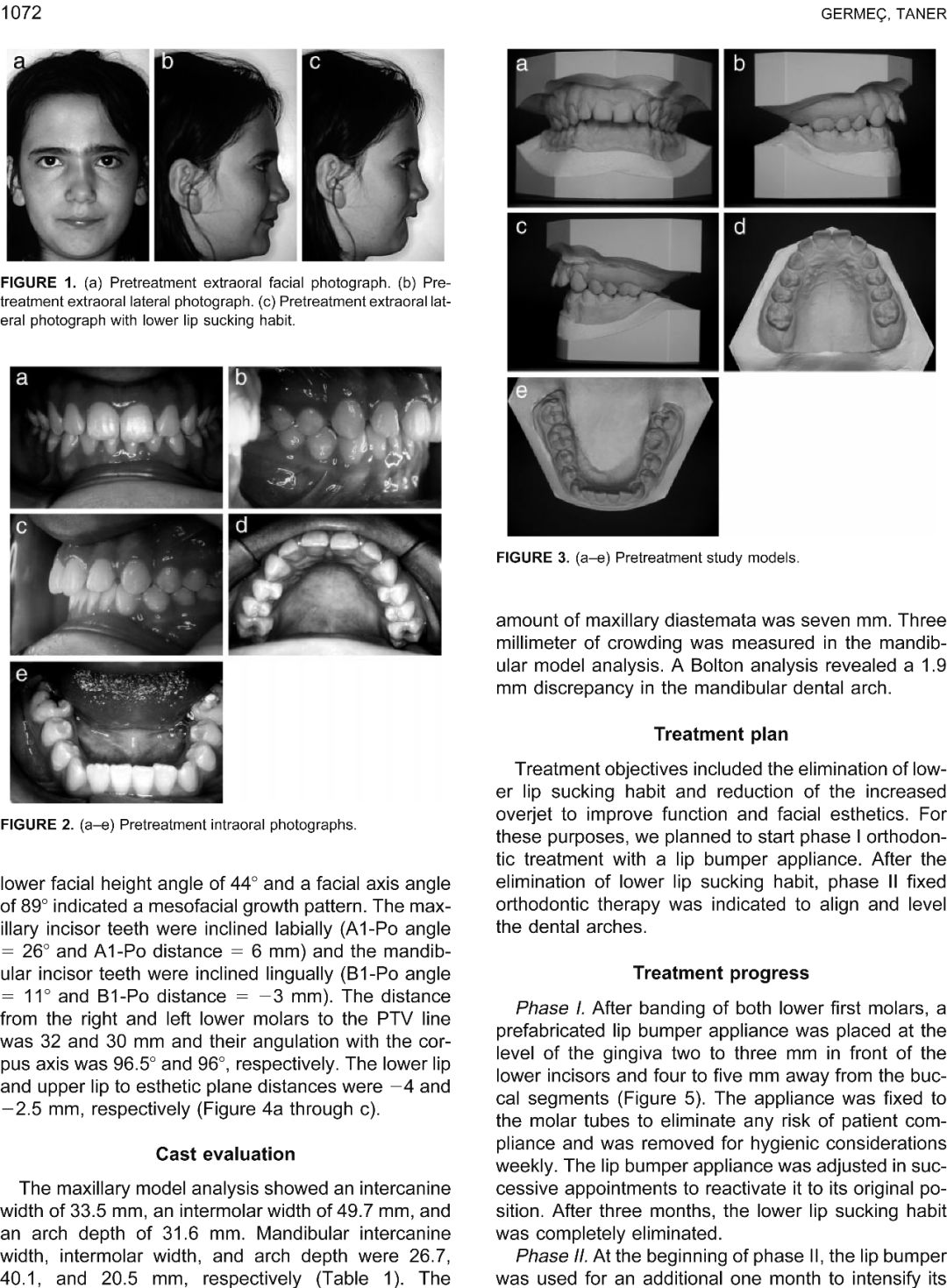 孩子睡觉吸吮怎么纠正,如何帮儿童戒掉吸吮手指