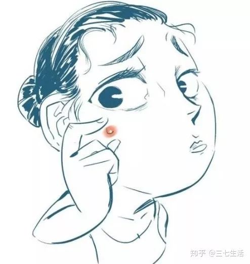 一夏季皮肤病轮番上阵如何应对,皮肤病如何避免