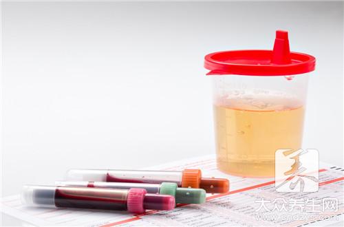 发热小便颜色呈深褐色,小便深褐色是什么原因引起的