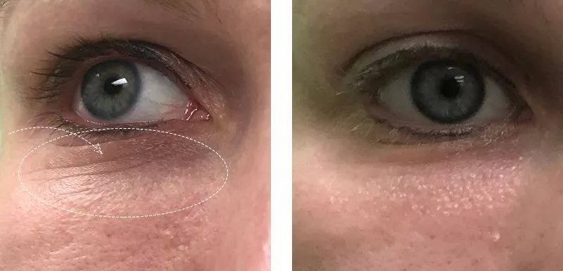 又是激凸又是露底，“蜜桃肌”的盛世美颜也有翻车时