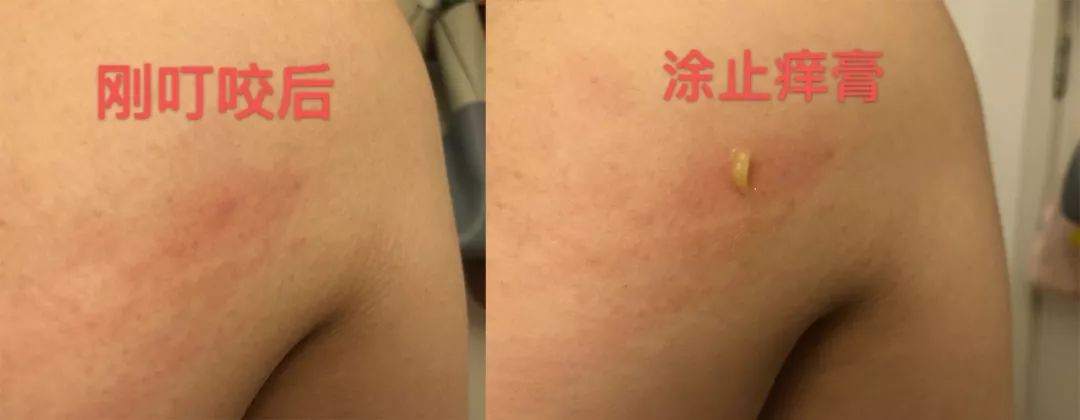 最有效的修复膏,市面好用的修复膏