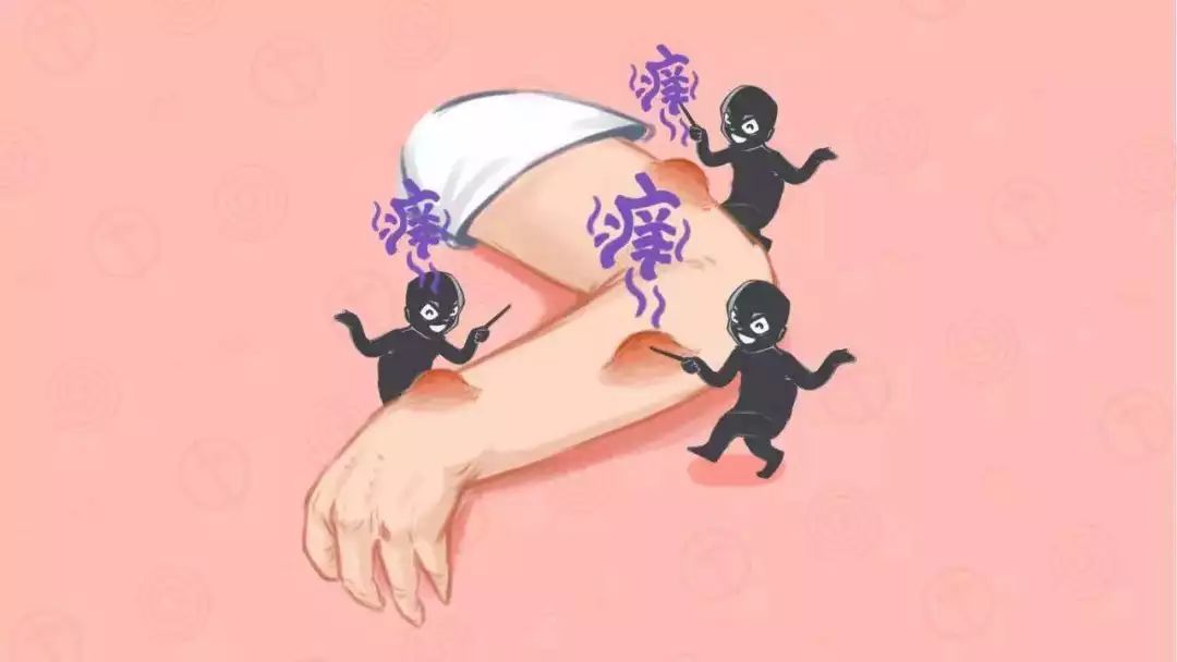 如何止痒被蚊子叮的包,驱蚊子叮咬包的好方法