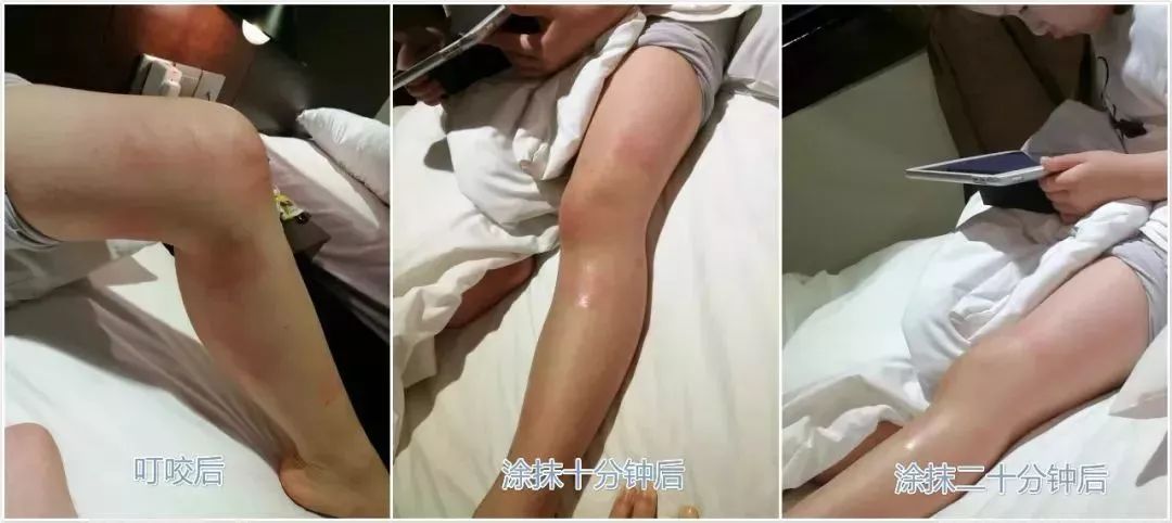 保湿、消炎、止痒、晒后修复,一管芦荟胶全搞定,宝宝也能用