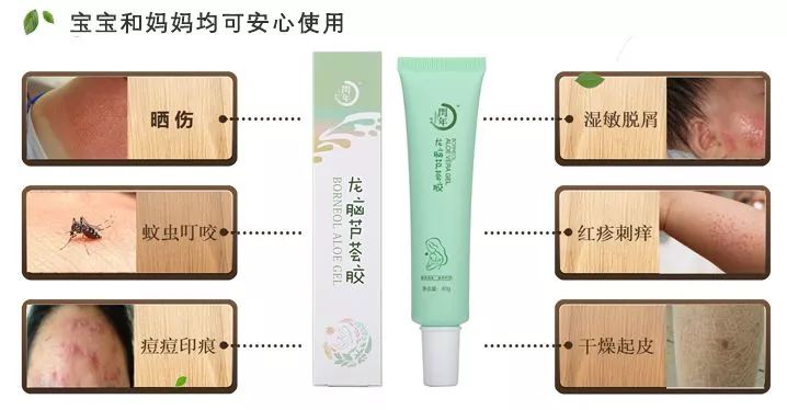 补水保湿晒后修复消炎杀菌,芦荟胶舒缓保湿凝胶儿童可以用吗