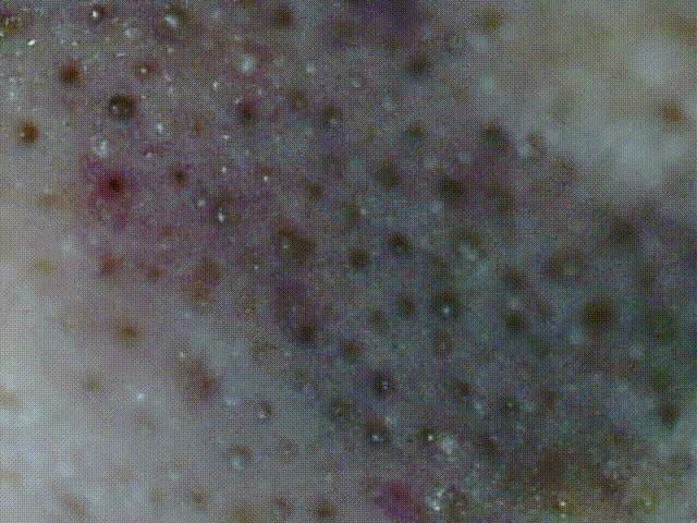 拯救毛孔黑头,清除黑头大毛孔的利器