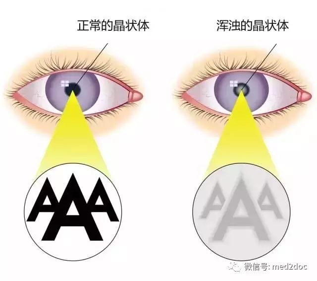 五分钟搞明白体检报告值得收藏,最全体检报告值得收藏