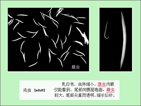 宝宝总说屁股痒怎么回事,宝宝老说屁屁疼是不是肚子里有虫
