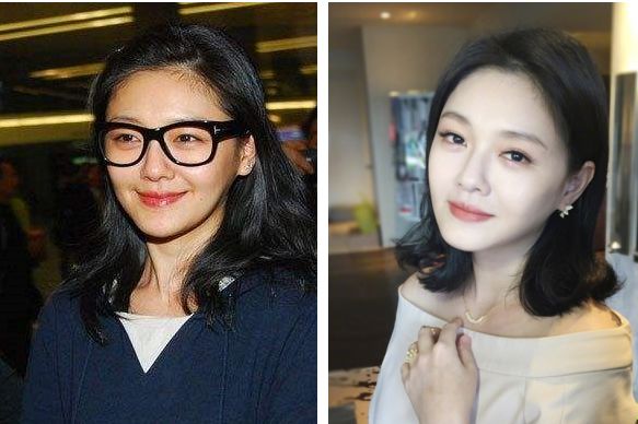 黑科技一秒祛斑,黑科技美白真的有效吗