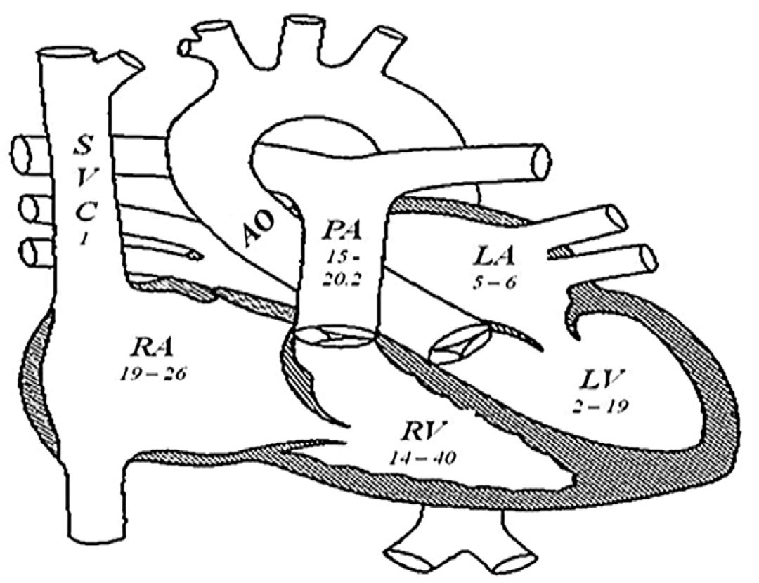 冠状动脉瘘是怎么回事,冠状动脉瘘原因