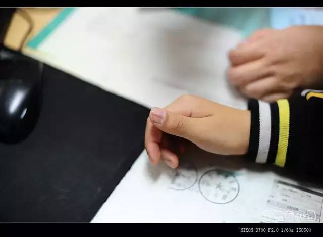 哪个部位的痣会有癌变风险,身体上已有的痣容易癌变吗