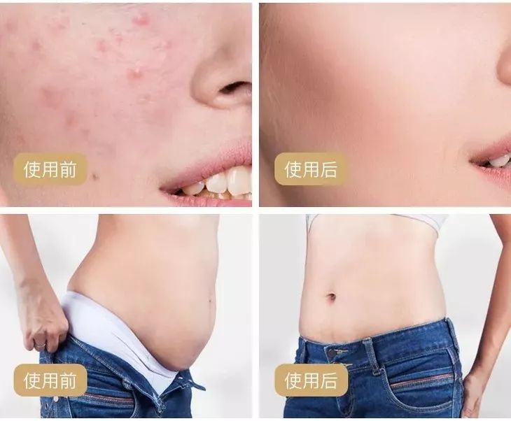 睡前泡脚抗衰老,泡脚水里加点它养生效果翻倍