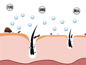 严重的黑头怎么处理教程,反复黑头的原因和解决方法