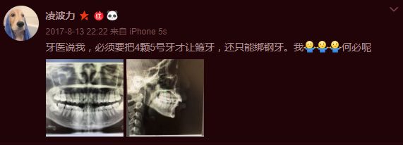 大龄整牙,错过生长发育期怎么办