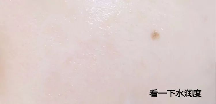 脸上搓下来很多泥,脸上搓出黑头