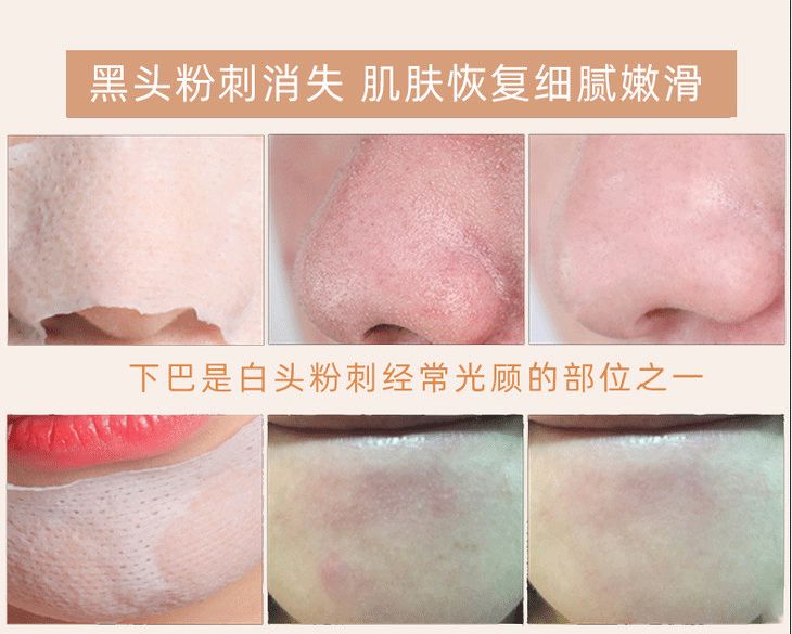 一抹吸出黑头,鸡蛋清除黑头