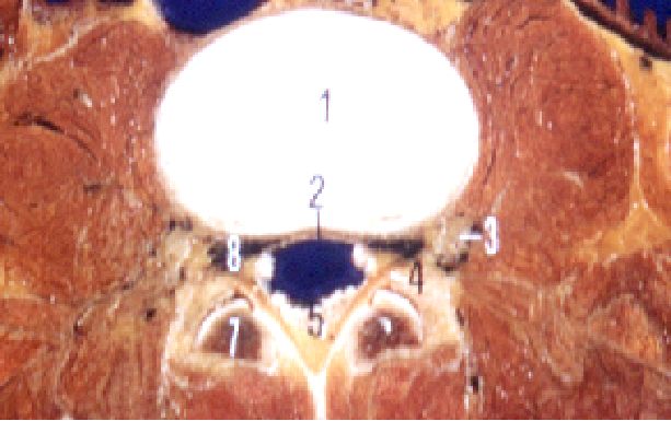 一分钟带你了解腰椎狭窄,椎管狭窄症知识大全