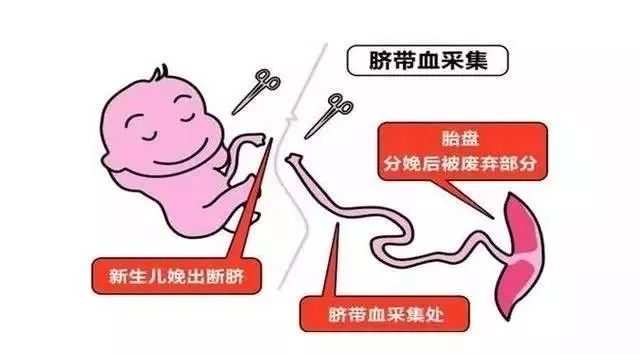 郑州脐带血保存,医院储存脐带血内幕