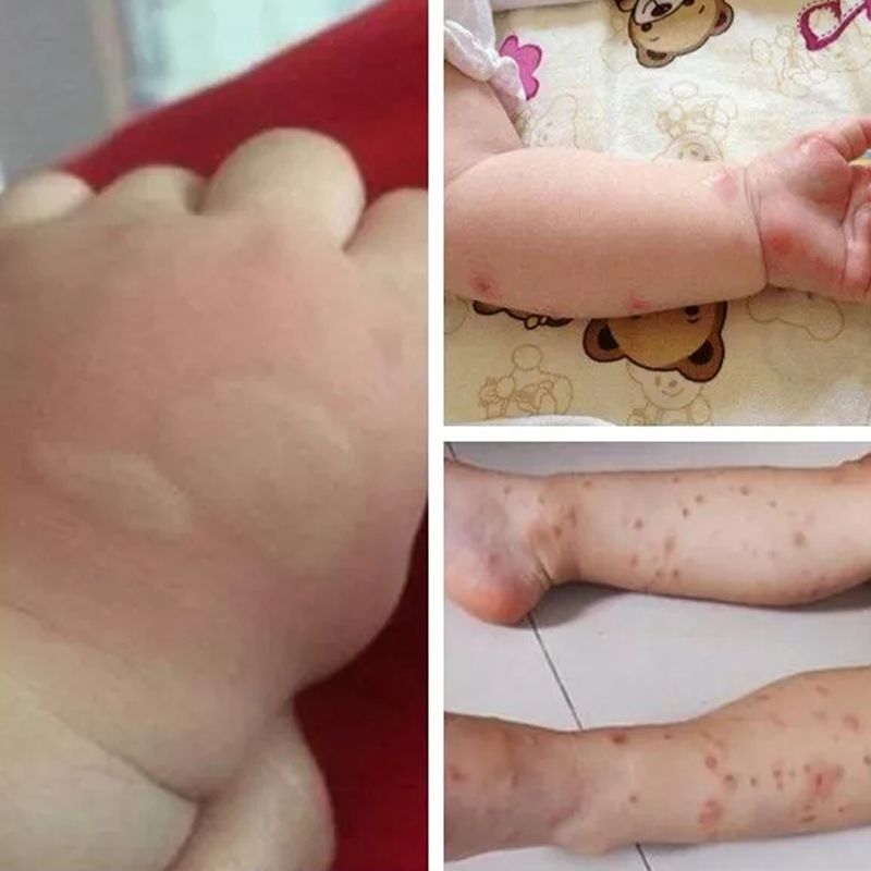 植物妈妈驱蚊喷雾,植物萃取喷雾防蚊驱蚊