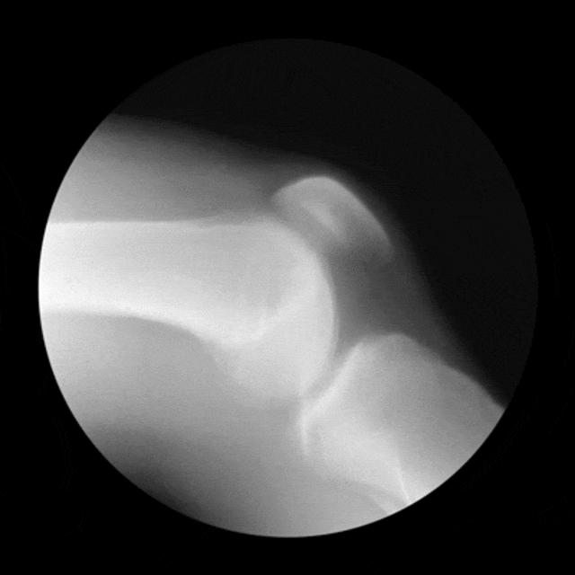 膝盖疼怎样鉴别自己属于哪种病,膝盖各个部位疼痛图解判断方法