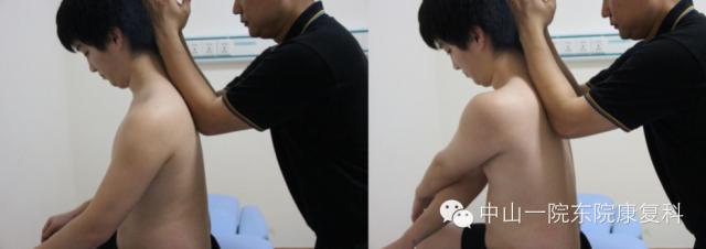 筋膜的康复训练方法,12条筋膜链解析及治疗手法